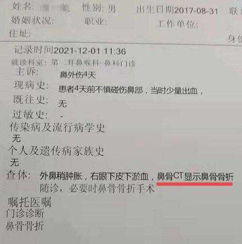 沈阳4岁小孩在早教中心摔成鼻骨骨折，后续赔偿起争议